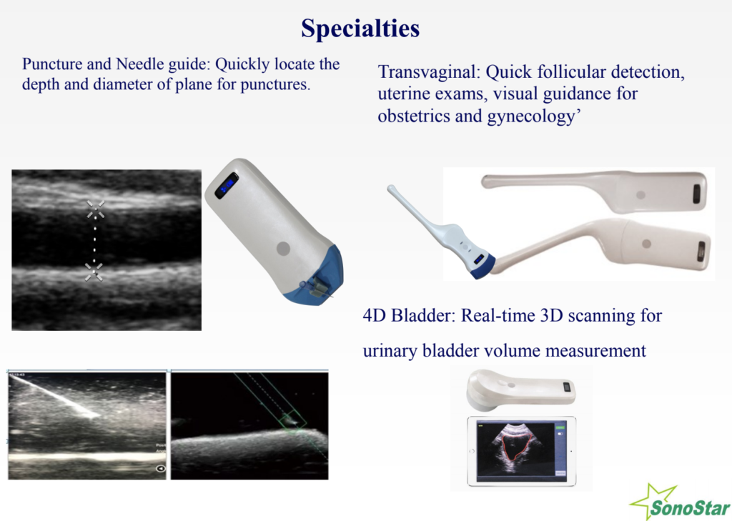 Sonostar Wireless Handheld Ultrasound ZG Worldwide